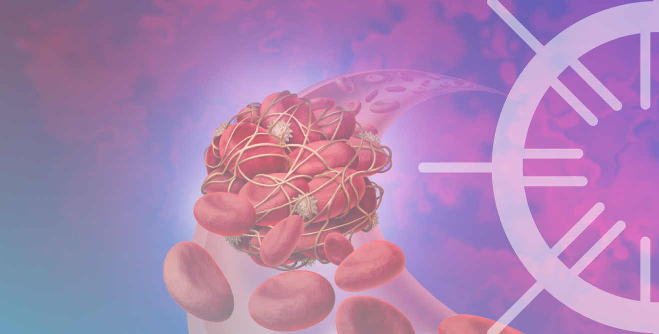 Особенности профилактики тромбоэмболических осложнений у пациента с ИБС и ХБП